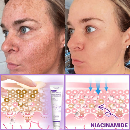 Boutique officielle✅ : Vitalisys® PDRN Crème Corps avec Roller 🎉 – Anti-âge, hydratation, fermeté et régénération. Pour un teint unifié, traite acné, taches pigmentaires et verrues 💎
