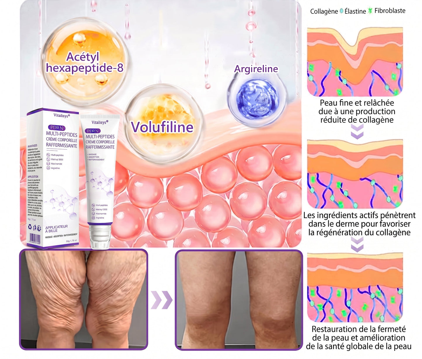 Boutique officielle✅ : Vitalisys® PDRN Crème Corps avec Roller 🎉 – Anti-âge, hydratation, fermeté et régénération. Pour un teint unifié, traite acné, taches pigmentaires et verrues 💎