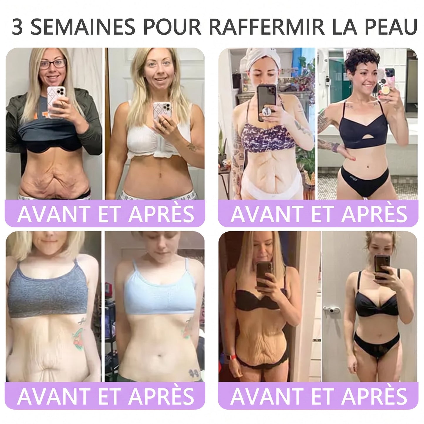 Boutique officielle✅ : Vitalisys® PDRN Crème Corps avec Roller 🎉 – Anti-âge, hydratation, fermeté et régénération. Pour un teint unifié, traite acné, taches pigmentaires et verrues 💎