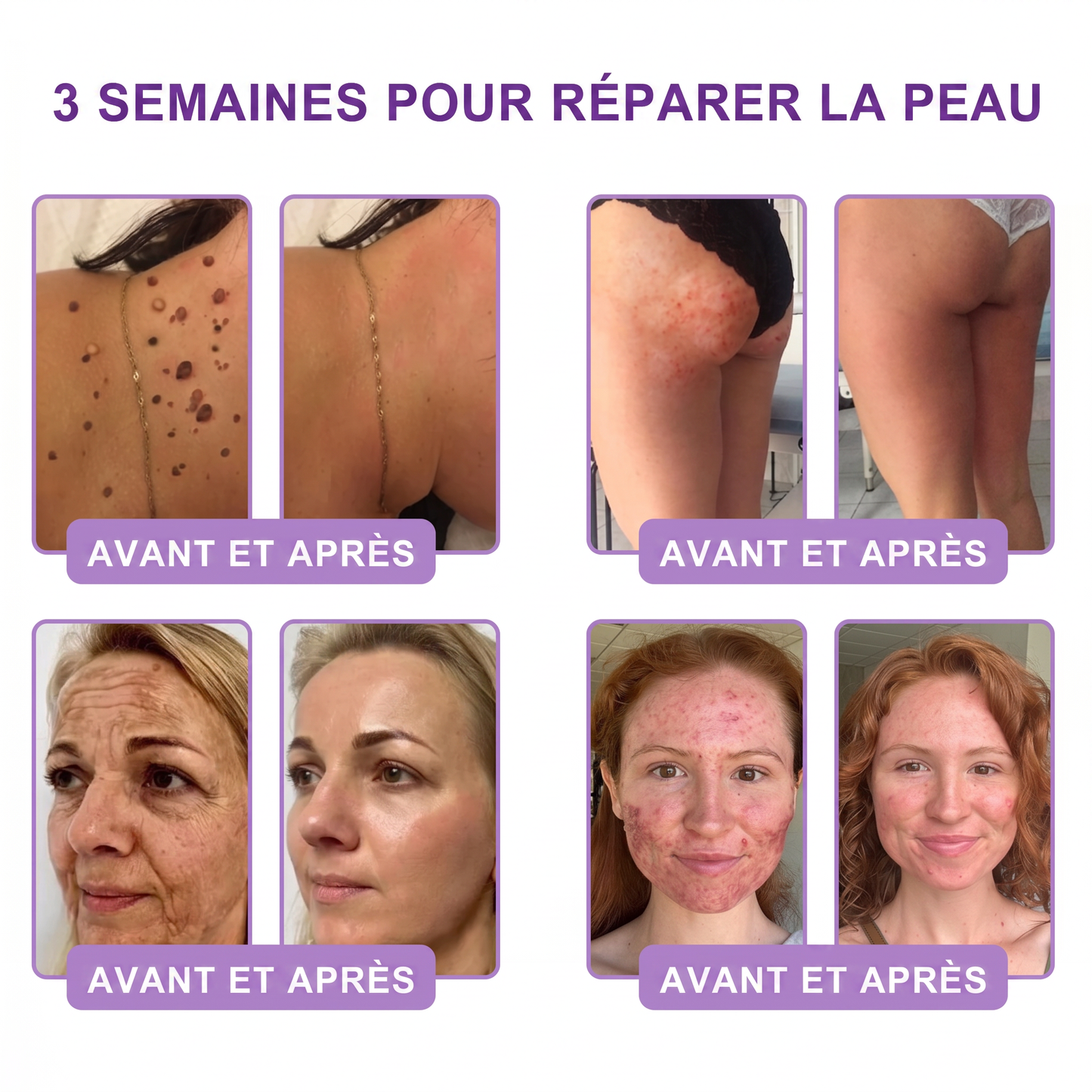 Boutique officielle✅ : Vitalisys® PDRN Crème Corps avec Roller 🎉 – Anti-âge, hydratation, fermeté et régénération. Pour un teint unifié, traite acné, taches pigmentaires et verrues 💎