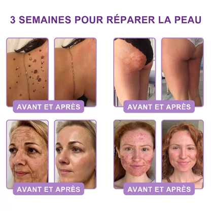 Boutique officielle✅ : Vitalisys® PDRN Crème Corps avec Roller 🎉 – Anti-âge, hydratation, fermeté et régénération. Pour un teint unifié, traite acné, taches pigmentaires et verrues 💎