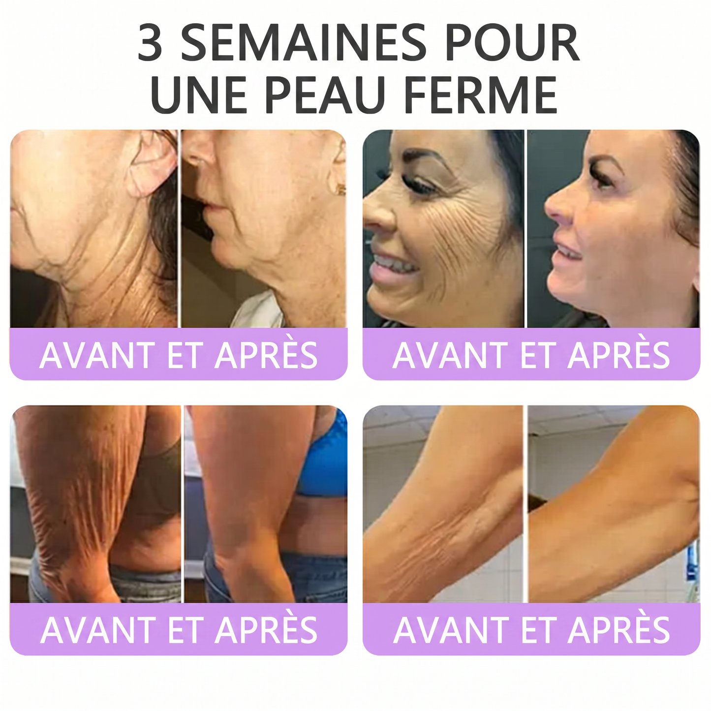 Boutique officielle✅ : Vitalisys® PDRN Crème Corps avec Roller 🎉 – Anti-âge, hydratation, fermeté et régénération. Pour un teint unifié, traite acné, taches pigmentaires et verrues 💎