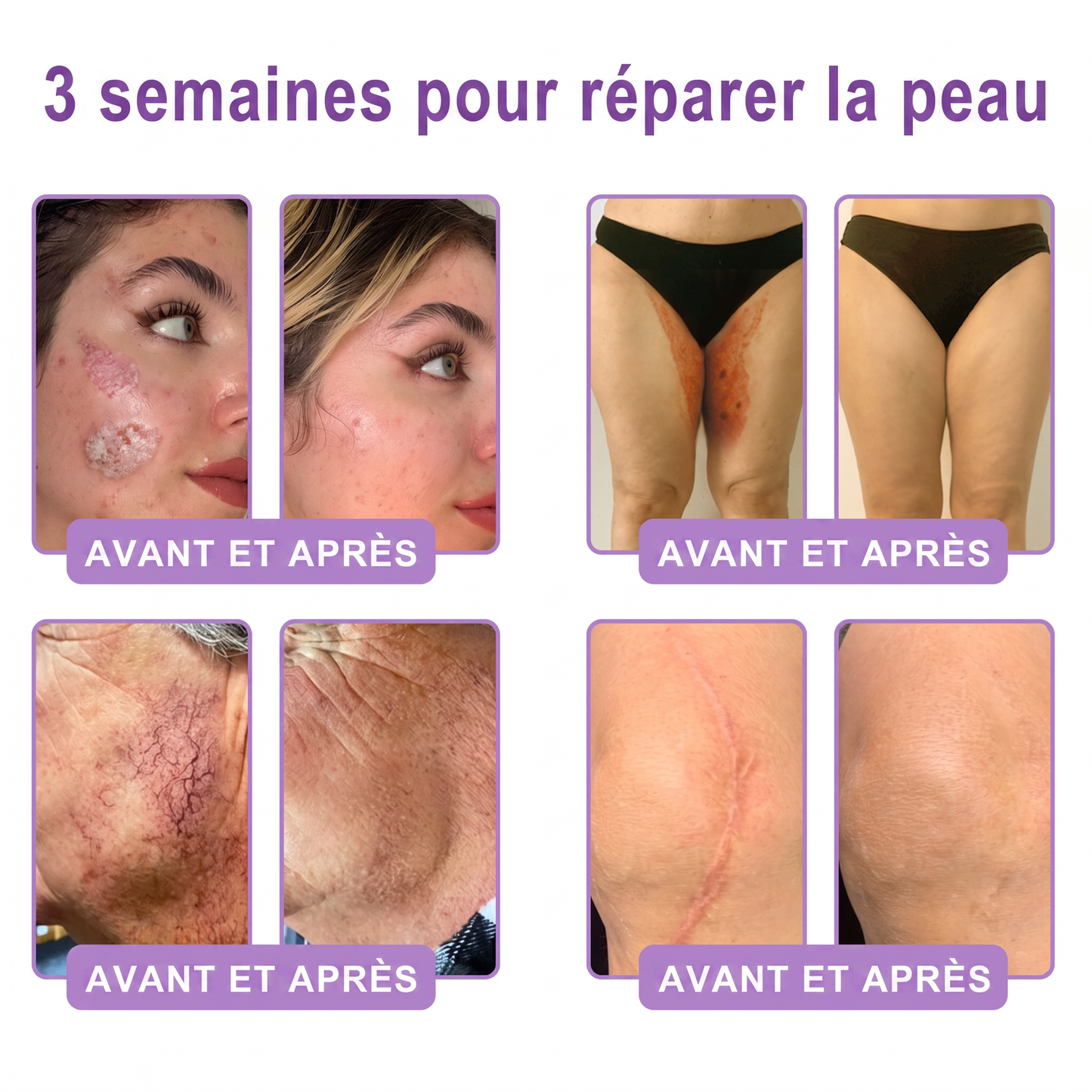 Boutique officielle✅ : Vitalisys® PDRN Crème Corps avec Roller 🎉 – Anti-âge, hydratation, fermeté et régénération. Pour un teint unifié, traite acné, taches pigmentaires et verrues 💎