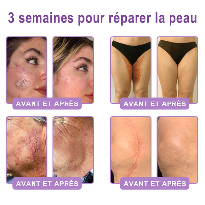 Boutique officielle✅ : Vitalisys® PDRN Crème Corps avec Roller 🎉 – Anti-âge, hydratation, fermeté et régénération. Pour un teint unifié, traite acné, taches pigmentaires et verrues 💎