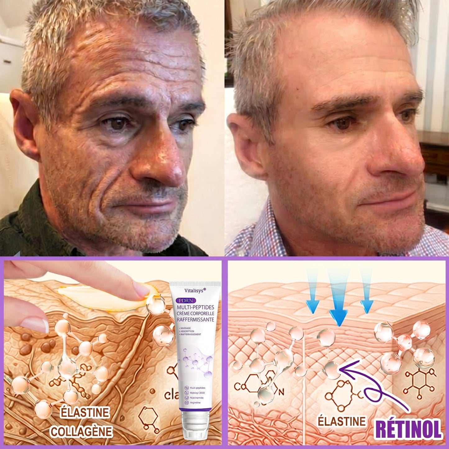 Boutique officielle✅ : Vitalisys® PDRN Crème Corps avec Roller 🎉 – Anti-âge, hydratation, fermeté et régénération. Pour un teint unifié, traite acné, taches pigmentaires et verrues 💎